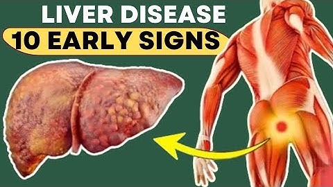 10 Early Warning Signs of Liver Damage | Liver Disease