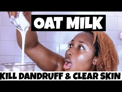 HOW TO- GET RID OF DANDRUFF, Dry, Itchy, Flaky Hair & Skin (w/ 2 kitchen ingredients!)