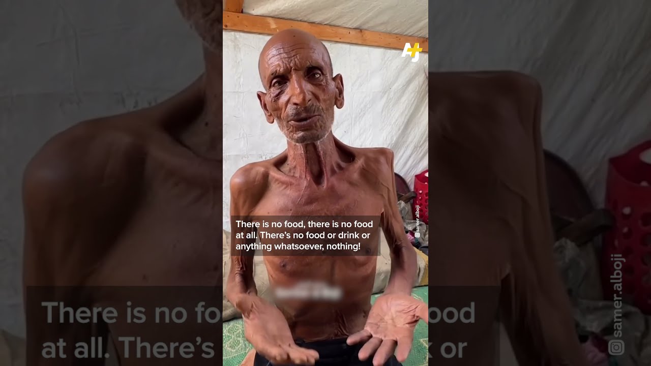 75 Year Old In Gaza Starving To Death Under Israeli Siege