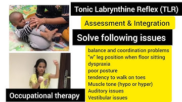 Tonic labyrinthine reflex (TLR)/ How to test & integrate TLR? primitive reflex/occupational therapy