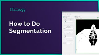 How to do Segmentation | Flowgy Academy