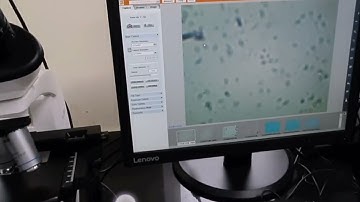 MICROSCOPE | COMPOUND MICROSCOPE WITH CAMERA AND COMPUTER VIEW