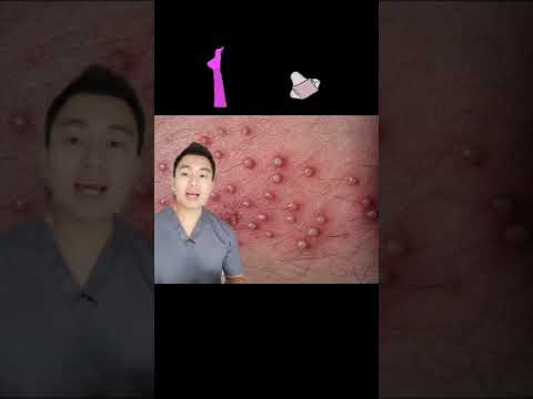 Sering jerawatan pada Miss V? #tipswanita #kesehatanmissv #kesehatanwanita #jerawat #viral