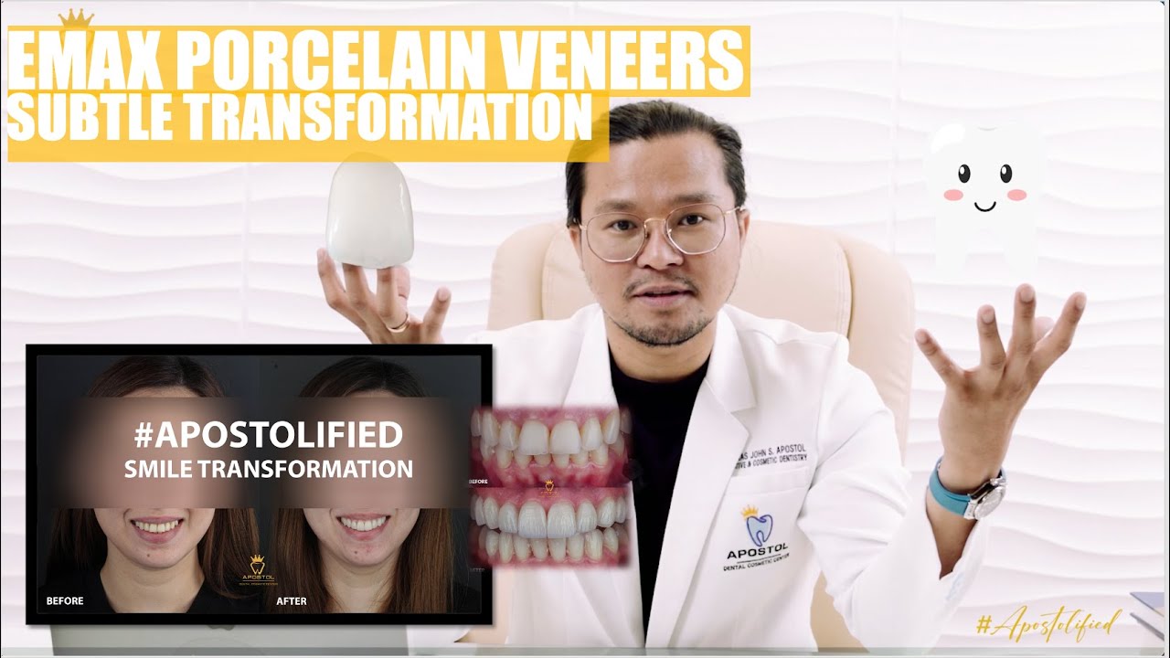 Emax Porcelain Veneers Smile Makeover Apostol Dental Philippines