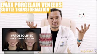 Emax Porcelain Veneers Smile Makeover | Apostol Dental Philippines