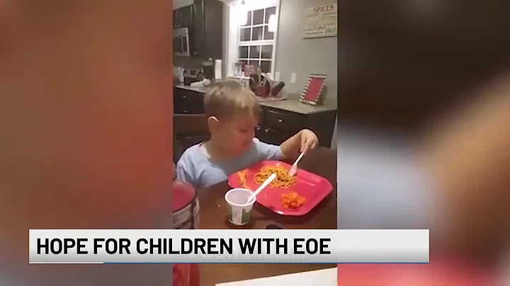 Breakthrough for picky eaters: Hope for children with EoE