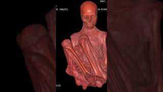 Paloma DICOM files to be released by Tridactyls.org in 2026.