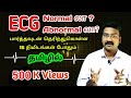 Ecg normal or abnormal find in 15 min  ecg in tamil learn ecg in tamil  ps tamil