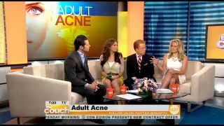 Adult Acne - Dr. Schweiger Speaks On Cbs New York