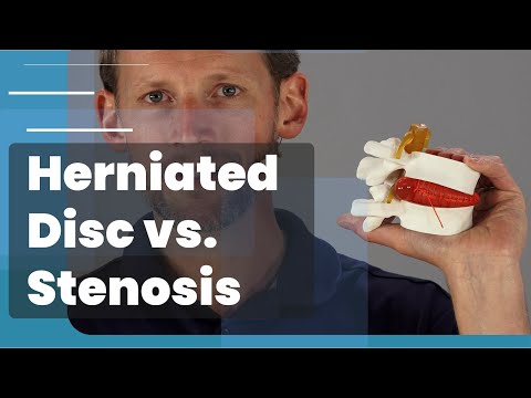 Herniated Disc VS Lumbar Stenosis