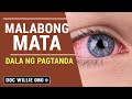 Malabong Mata: Dala ng Pagtanda - Payo ni Doc Liza Ong #261b