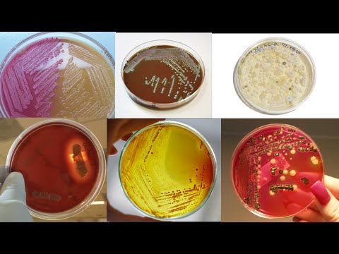 Different Types Of Agar Media And Their Uses