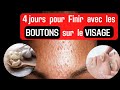 Comment eliminer les boutons sur le visage