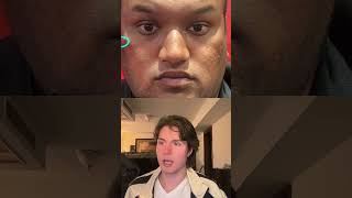 I Rated an Unattractive Subscriber’s Face + Gave Him Tips to Get ATTRACTIVE Profile