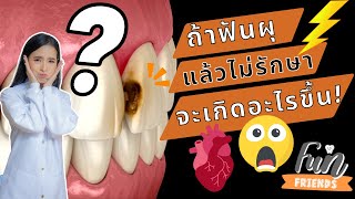 ถ้าฟันผุแล้วไม่รักษา จะเกิดอะไรขึ้น! |FunFriends เพื่อนกันฟันดี|