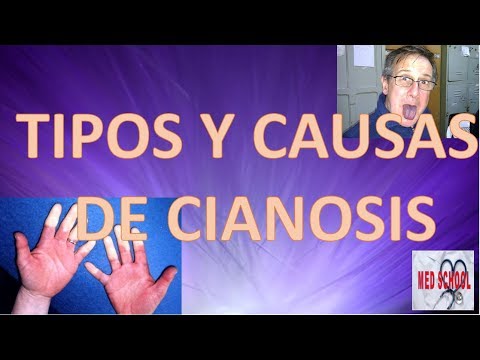 Video: Cianosis Azul