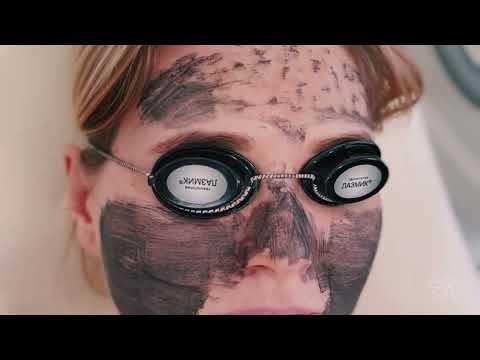 Карбоновый пилинг лица