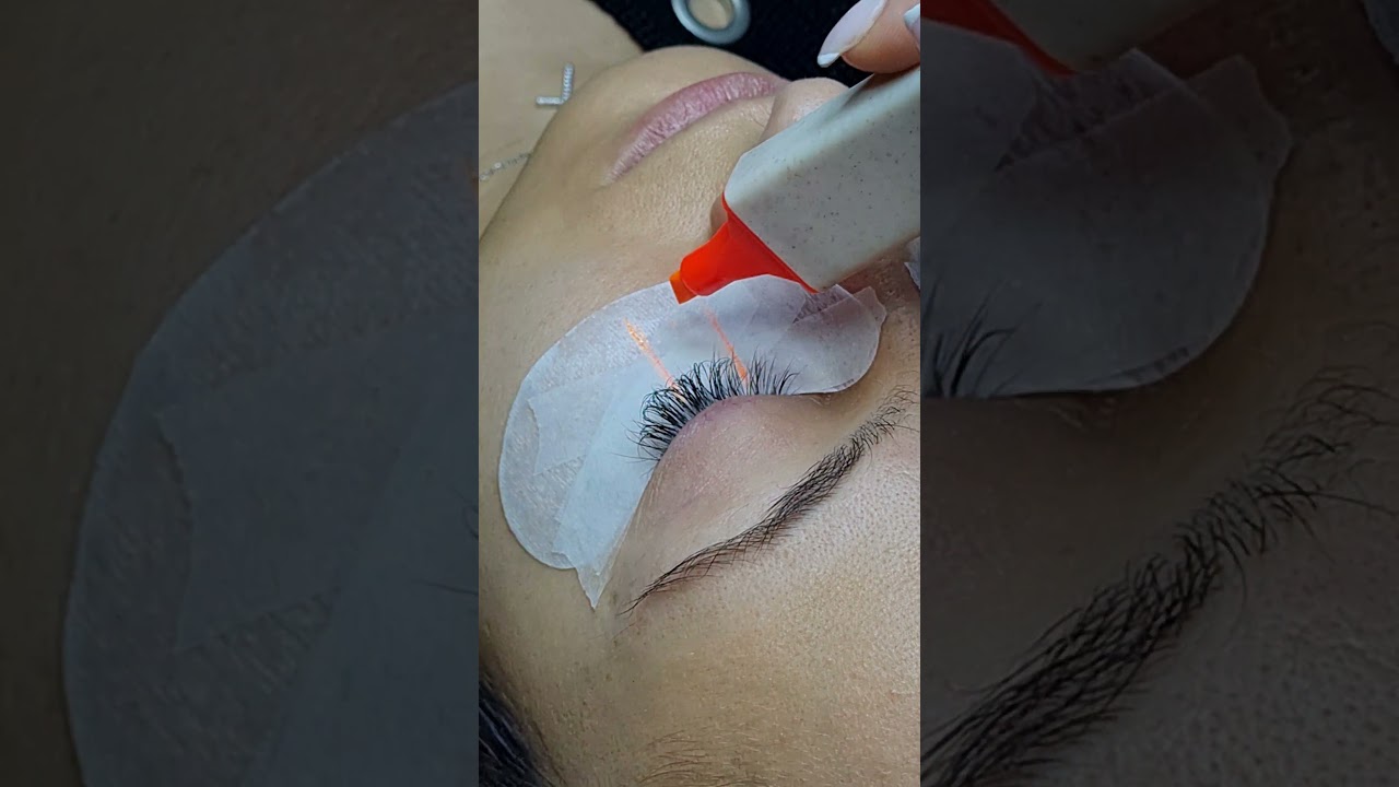 Cum depistam globul ocular și desenem schema pe pach