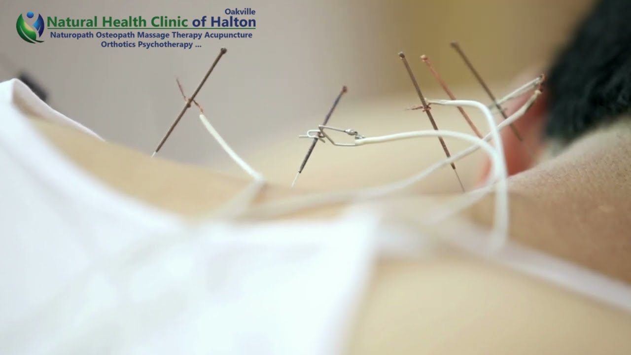 Acupuncture Clinic, Oakville video thumbnail