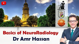 Basics of NeuroRadiology-أ.د. عمرو حسن الحسني