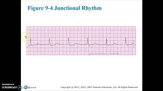 Cardiac Chapter 9 Video 3