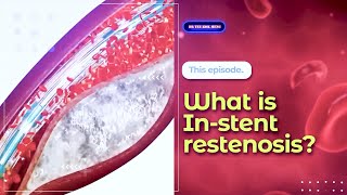 What is Instent restenosis?