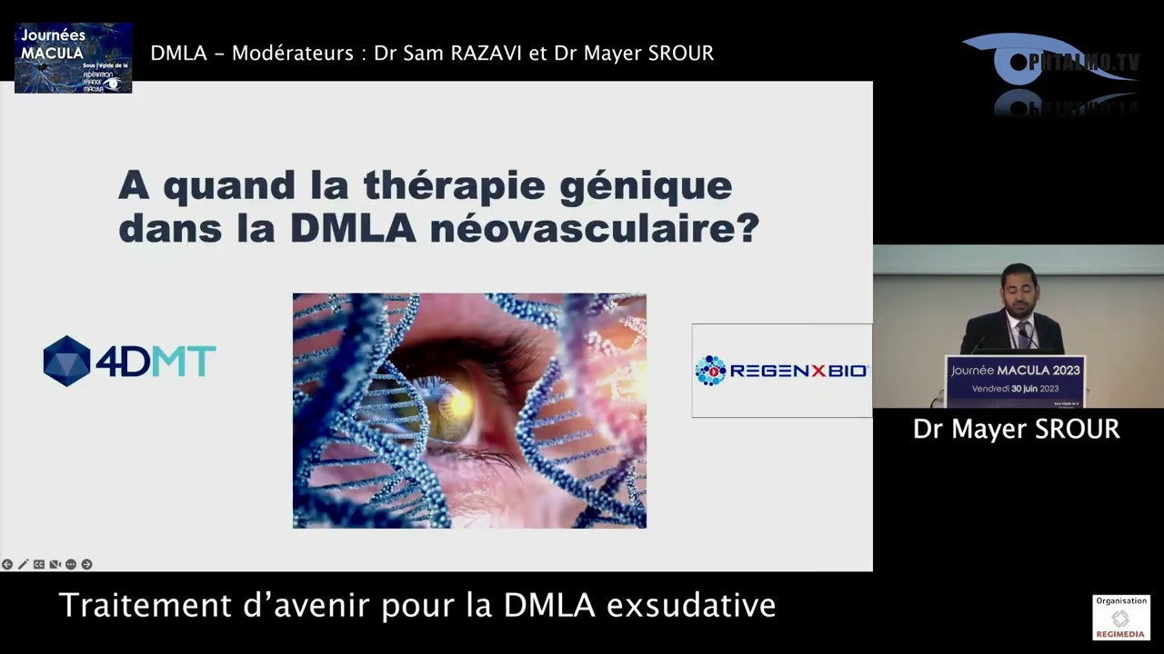 Dr Mayer Srour — Traitement d'avenir pour la DMLA exsudative (Macula 2023)