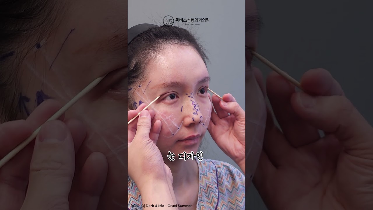 [Вэвэрс Гоо сайхны мэс заслын эмнэлэг] Алдартай ТикТокерын😮хамгийн гайхалтай мэс заслын бодит үр дүнгийн түүх