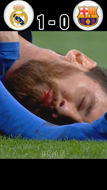 The day Messi got injured and became unstoppable