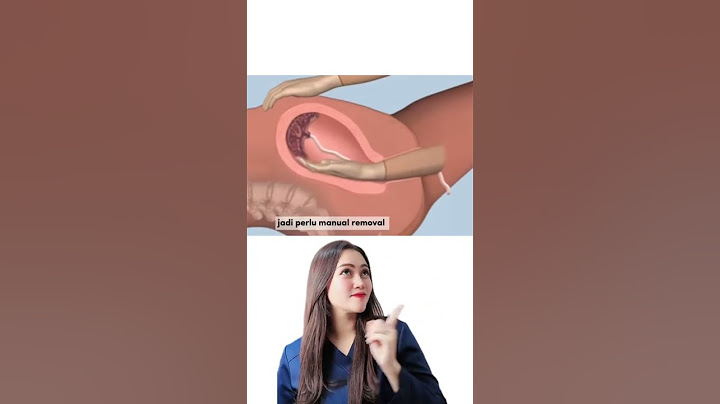 Perjuangan seorang Ibu Hamil - Medikacare