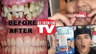 PERFECT SMILE VENEERS REVIEW As Seen on TV! screenshot 4