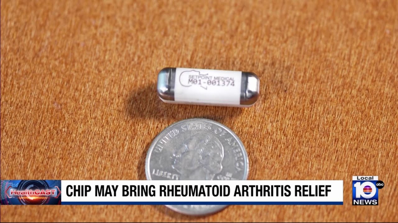 Rheumatoid arthritis patients find relief with a clinical trial