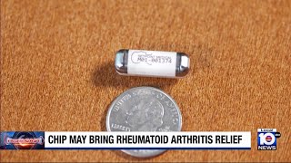 Rheumatoid arthritis patients find relief with a clinical trial