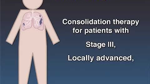 Improving Survival in Lung Cancer