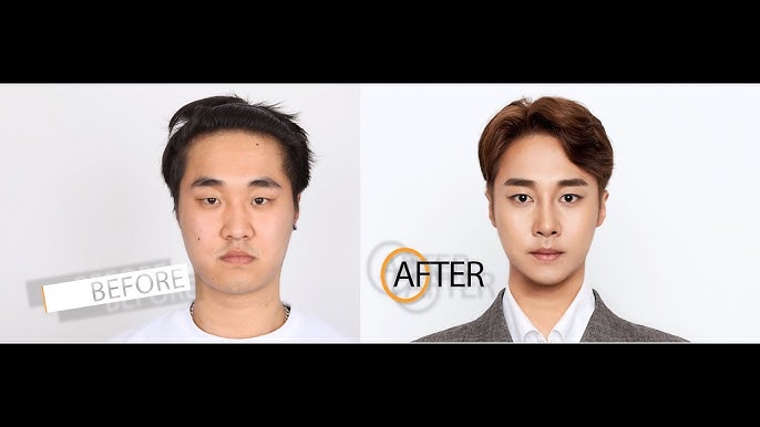 korean plastic surgery before and after jaw