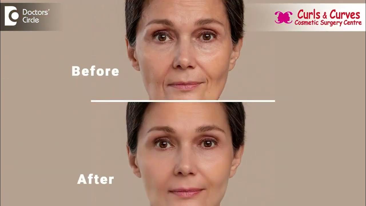 Dr Curves Advanced Plastic Surgery Solutions Facelift Procedure Steps | Dr. Girish A C | Curls & Curves Cosmetic
