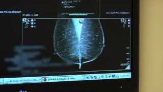 Getting a Read on Breast Cancer