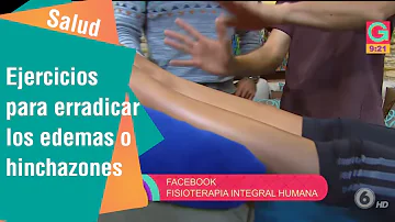 Qual a diferença entre inchaço e edema?