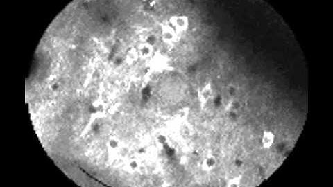 In vivo spontaneous cortical activity in a stargazer mouse recorded with Gcamp6m