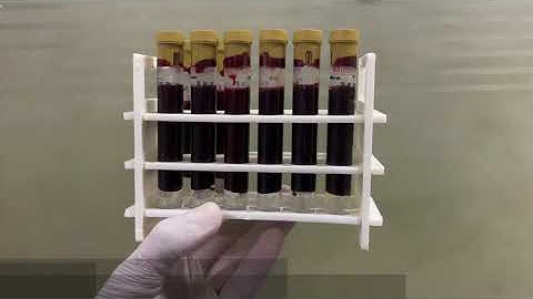 What Is P SHOT FOR Men | PRP  Injections Live Demo | Non- Surgical Erectile Dysfunction Treatment