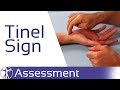 Tinel Sign of the Wrist | Carpal Tunnel Syndrome (CTS)
