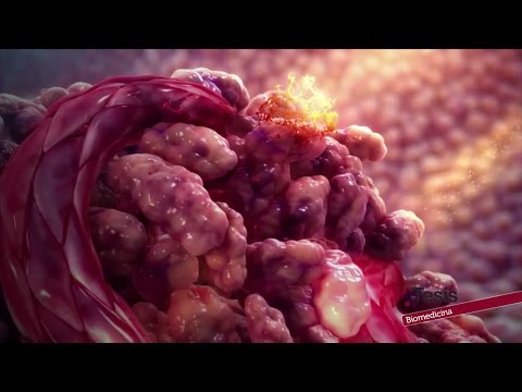 Vídeo: Productes Contra El Càncer