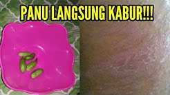 RESEP NENEK MOYANG PALING AMPUH,,, Cara menghilangkan Panu pada kulit - Durasi: 3.50. 