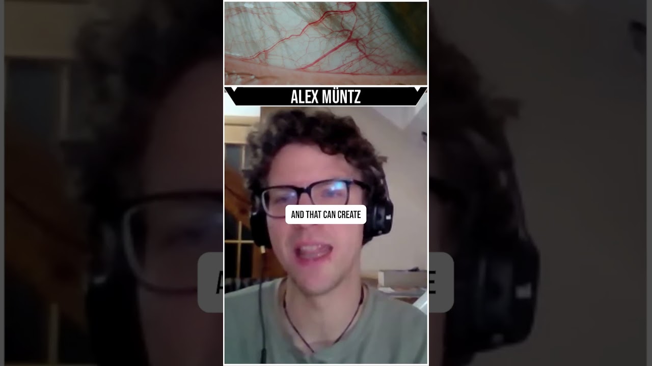 The Danger Of Leaving Contacts In