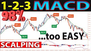 🔴 1-2-3 EMA-MACD "SCALPING" Strategy - One of The Best Absolute Methods for Trading