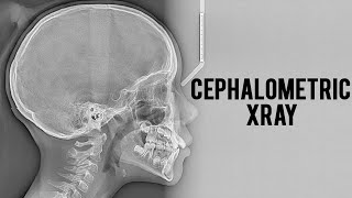 Do you NEED a Ceph for that Orthodontic Case?