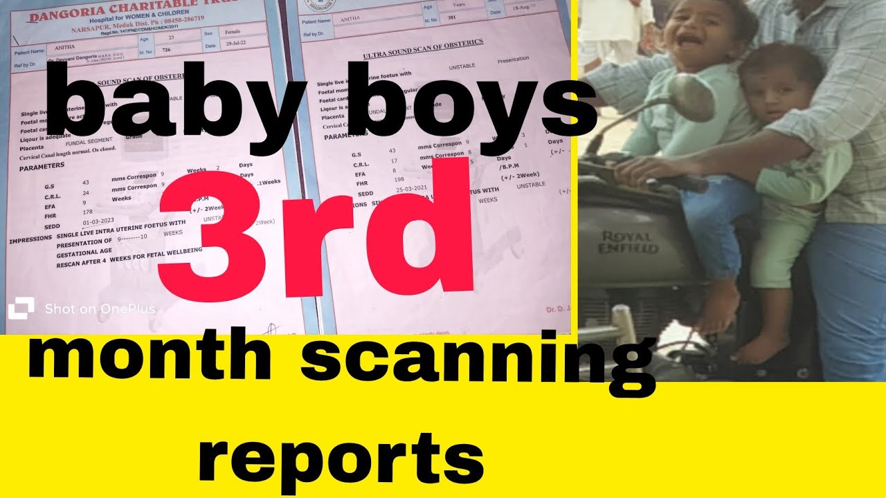 baby boys 3rd(first) month scannings #nt scan#ultra sound scan # ...