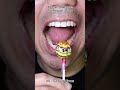 Most Satisfying Candy &amp; Chocolate ASMR 🍫🍬 #DoctorTristanPeh #ASMR