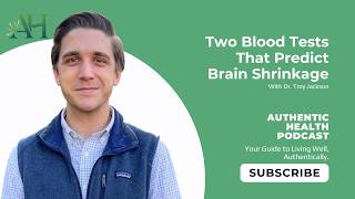 Celebrity The Two Blood Tests That Predict Brain Shrinkage Net Worth