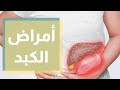أمراض الكبد وتشخيصها وعلاجها أمراض الكبد وتشخيصها وعلاجها